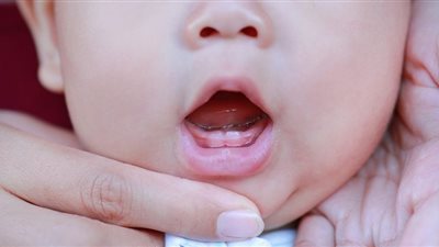 أعراض تسنين الأطفال    