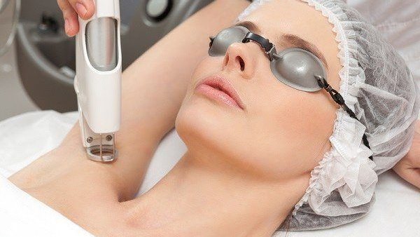 إزالة الشعر بالليزر..