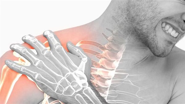 متلازمة الكتف المتجمدة