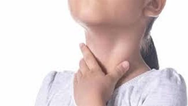 أعراض انتفاخ الوريد