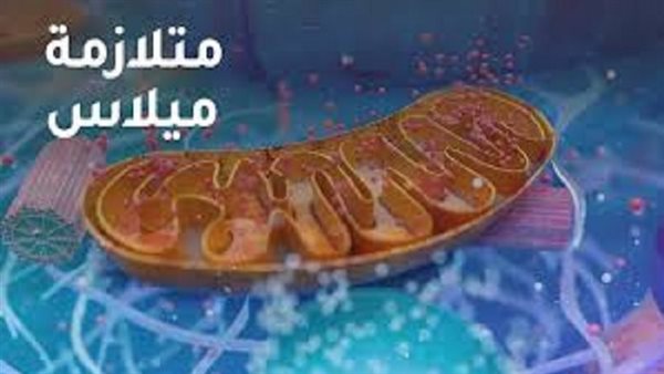 متلازمة آرلن